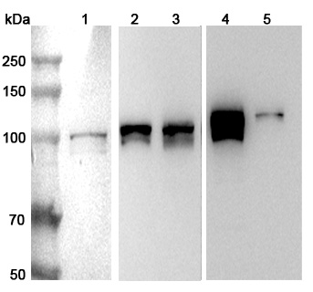 Anti-Human RBM15 Polyclonal Antibody binds to Recombinant Human RBM15 Protein, N-His in WB Assay