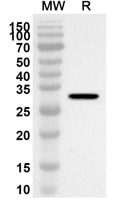 Anti-Human RBX1 Polyclonal Antibody binds to Recombinant Human RBX1 Protein, N-GST & C-His in WB Assay