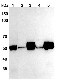 Anti-Human RCOR1 Polyclonal Antibody binds to Recombinant Human RCOR1 Protein, N-His in WB Assay