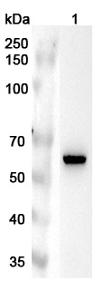 Anti-Human RGS14 Polyclonal Antibody binds to Recombinant Human RGS14 Protein, N-His in WB Assay