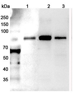Anti-Human RHOT2 Polyclonal Antibody binds to Recombinant Human RHOT2 Protein, N-His in WB Assay