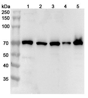 Anti-Human RIOK3 Polyclonal Antibody binds to Recombinant Human RIOK3 Protein, N-His in WB Assay