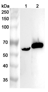 Anti-Human RIOX2 Polyclonal Antibody binds to Recombinant Human RIOX2 Protein, N-His in WB Assay