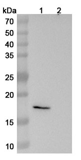 Anti-Human RNF43 Antibody (ABS1403)