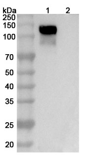 Anti-Human ROBO1 Antibody (ABS0890)