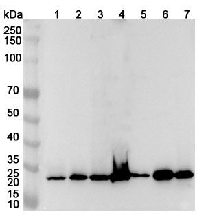 Anti-Human RPA2 Polyclonal Antibody binds to Recombinant Human RPA2 Protein, N-His in WB Assay