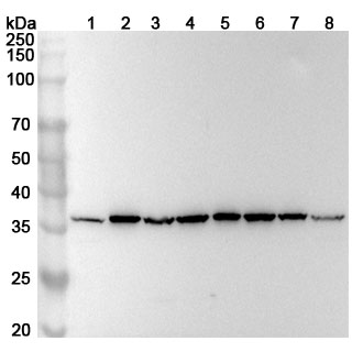 Anti-Human RPLP0 Polyclonal Antibody binds to Recombinant Human RPLP0 Protein, N-His in WB Assay