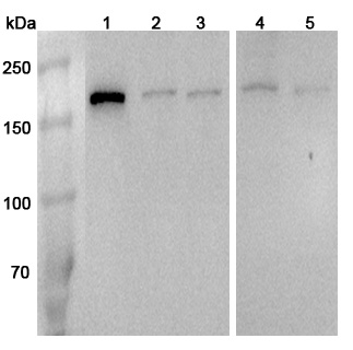 Anti-Human RPTOR Polyclonal Antibody binds to Recombinant Human RPTOR Protein, N-His in WB Assay
