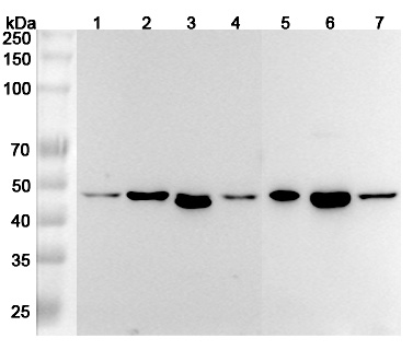 Anti-Human RSAD2 Polyclonal Antibody binds to Recombinant Human RSAD2 Protein, N-His in WB Assay