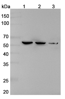 Anti-Human RTCB Polyclonal Antibody binds to Recombinant Human RTCB, N-His in WB Assay