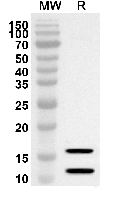 Anti-Human S100A8 & S100A9 Polyclonal Antibody in WB Assay