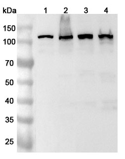 Anti-Human SART1 Polyclonal Antibody binds to Recombinant Human SART1 Protein, N-His in WB Assay