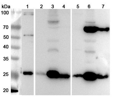 Anti-Human SDHB Polyclonal Antibody binds to Recombinant Human SDHB Protein, N-His in WB Assay