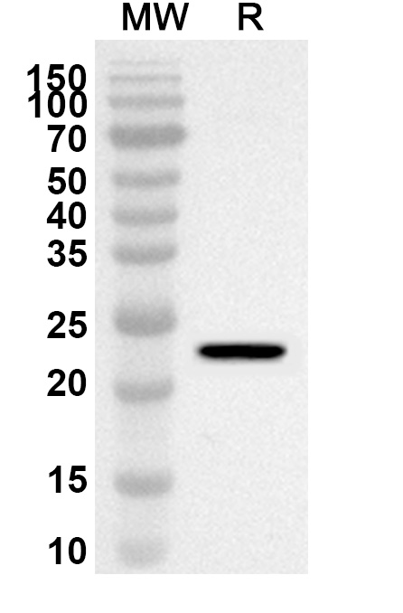 Anti-Human SERPINA2 Polyclonal Antibody binds to Recombinant Human SERPINA2, N-His in WB Assay