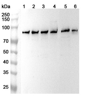 Anti-Human SH3BP2 Polyclonal Antibody binds to Recombinant Human SH3BP2 Protein, N-His in WB Assay