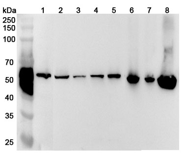 Anti-Human SHMT1 Polyclonal Antibody binds to Recombinant Human SHMT1 Protein, N-His-SUMO in WB Assay