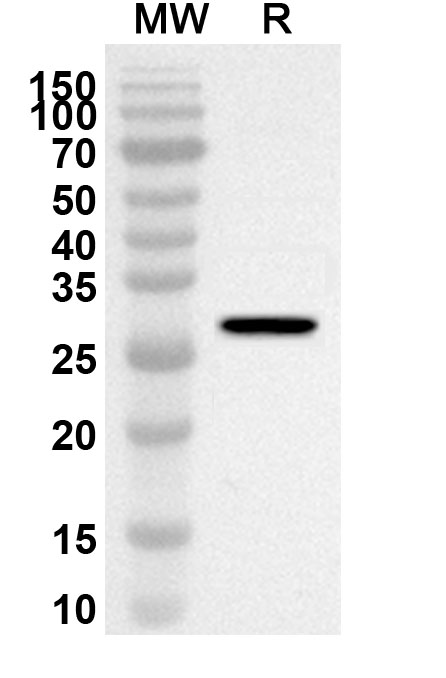 Anti-Human SIRPB1 Polyclonal Antibody binds to Recombinant Human CD172b/SIRPB1 Protein, N-His in WB Assay