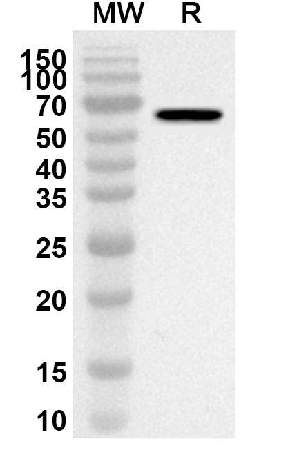 Anti-Human SLC26A8 Polyclonal Antibody binds to Recombinant Human SLC26A8, N-GST in WB Assay