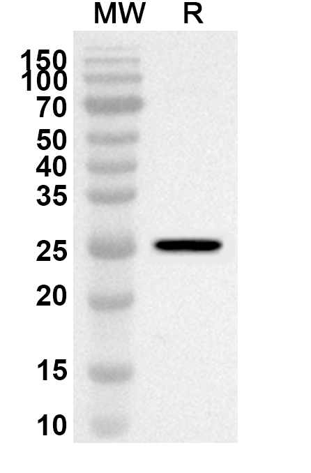 Anti-Human SLC2A10 Polyclonal Antibody binds to Recombinant Human SLC2A10 Protein, N-His-KSI in WB Assay