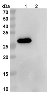 Anti-Human SLC34A2/NaPi2b Antibody (SAA2315) in WB Assay