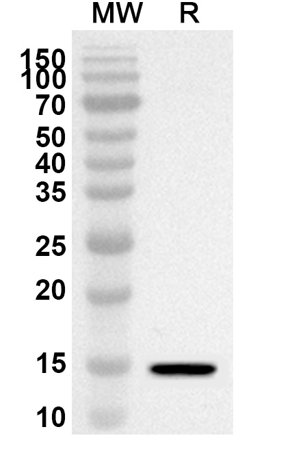 Anti-Human SLC9A3R1 Polyclonal Antibody binds to Recombinant Human SLC9A3R1 Protein, N-His in WB Assay