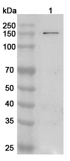 Anti-Human SMC2 Polyclonal Antibody binds to Recombinant Human SMC2 Protein, N-His in WB Assay