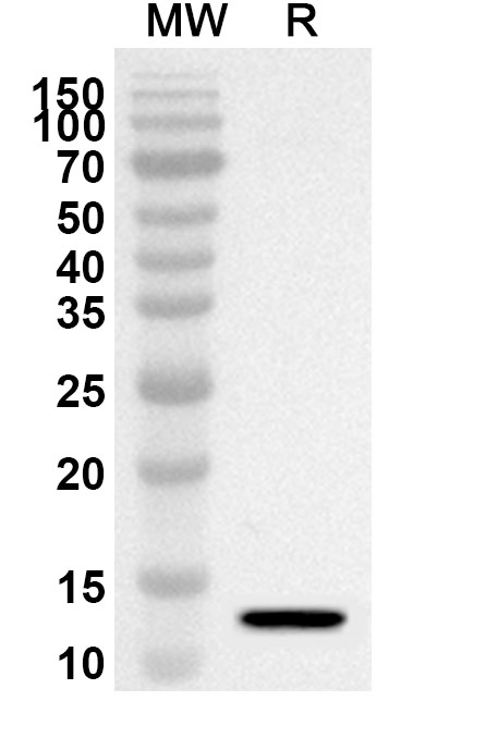 Anti-Human SNRPA Polyclonal Antibody binds to Recombinant Human SNRPA Protein, N-His in WB Assay