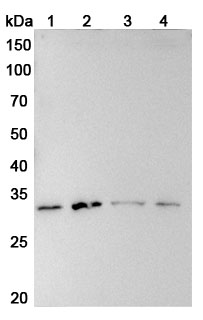 Anti-Human SOCS1 Polyclonal Antibody binds to Recombinant Human SOCS1 Protein, N-His in WB Assay
