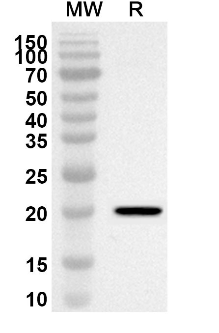 Anti-Human SORBS1 Polyclonal Antibody binds to Recombinant Human SORBS1 Protein, N-His in WB Assay