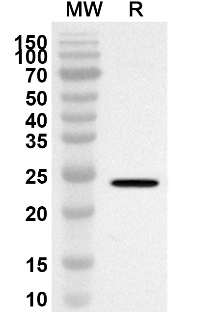 Anti-Human SPI1 Polyclonal Antibody binds to Human SPI1 Recombinant Protein, N-GST & C-His in WB Assay