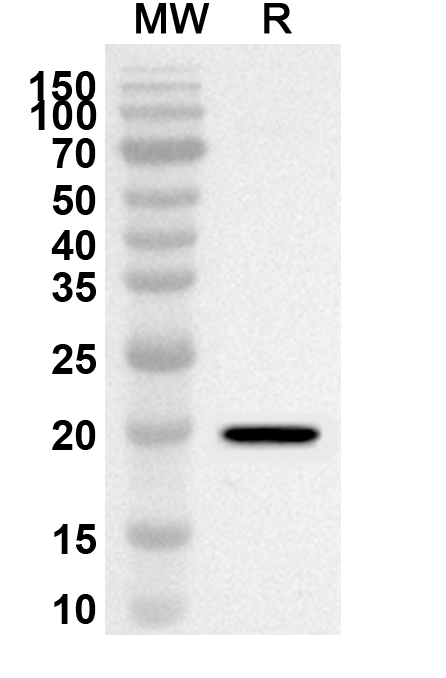 Anti-Human STMN3 Polyclonal Antibody binds to Recombinant Human STMN3 Protein, N-His-SUMO in WB Assay