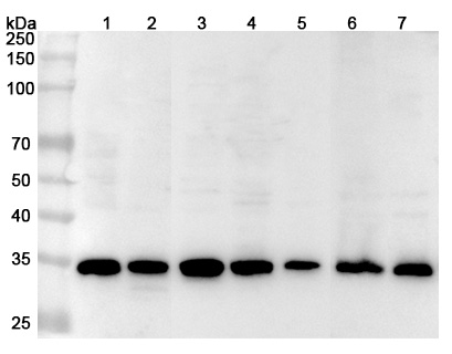 Anti-Human STUB1 Polyclonal Antibody binds to Recombinant Human STUB1 Protein, N-His in WB Assay