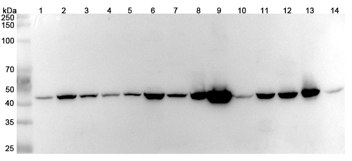 Anti-Human SUCLA2 Polyclonal Antibody binds to Recombinant Human SUCLA2 Protein, N-His in WB Assay