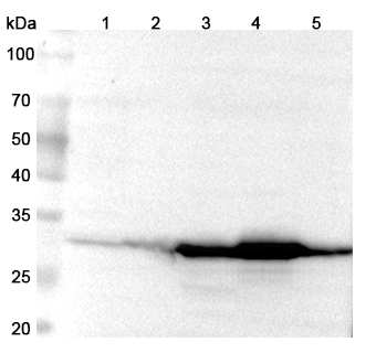 Anti-Human SULT1E1 Polyclonal Antibody binds to Recombinant Human SULT1E1 Protein, N-His in WB Assay