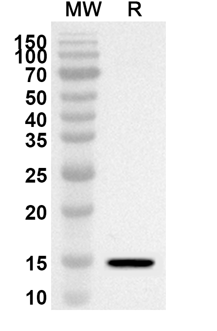 Anti-Human SUZ12 Polyclonal Antibody binds to Recombinant Human SUZ12 Protein, N-His in WB Assay
