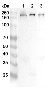 Anti-Human TJP2 Polyclonal Antibody binds to Human TJP2 Recombinant Protein, N-His in WB Assay