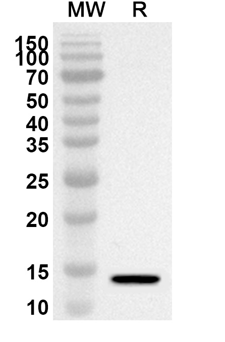Anti-Human TLR5 Polyclonal Antibody binds to Recombinant Human TLR5 Protein, N-His in WB Assay