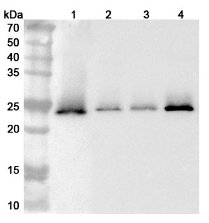 Anti-Human TMED9 Polyclonal Antibody binds to Recombinant Human TMED9 Protein, N-His in WB Assay