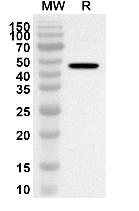 Anti-Human TMPRSS11E/DESC1 Polyclonal Antibody binds to Recombinant Human TMPRSS11E/DESC1 Protein, N-His in WB Assay