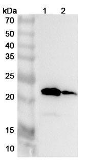 Anti-Human TNNC2 Polyclonal Antibody binds to Recombinant Human TNNC2 Protein, N-His in WB Assay