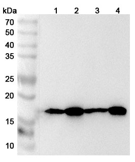 Anti-Human TOMM20 Polyclonal Antibody binds to Recombinant Human TOMM20 Protein, N-GST & C-His in WB Assay