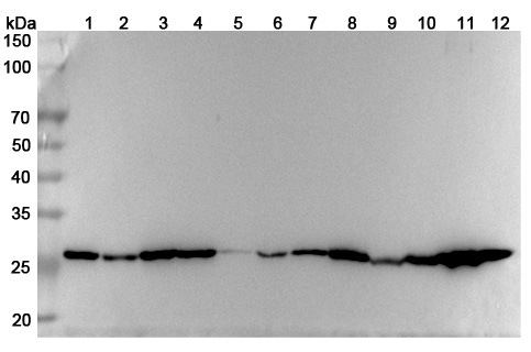 Anti-Human TPI1 Polyclonal Antibody binds to Recombinant Human TPI1 Protein, N-His in WB Assay
