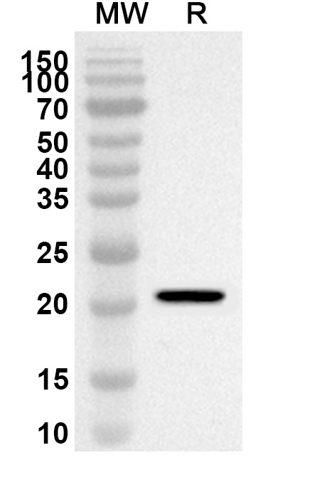 Anti-Human TRAIP Polyclonal Antibody binds to Human TRAIP Recombinant Protein, N-GST & C-His in WB Assay