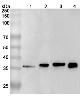 Anti-Human TREM2 Polyclonal Antibody binds to Mouse TREM2 recombinant protein in WB Assay
