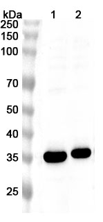 Anti-Human TREML2 Polyclonal Antibody binds to Recombinant Human TREML2 Protein, N-His in WB Assay