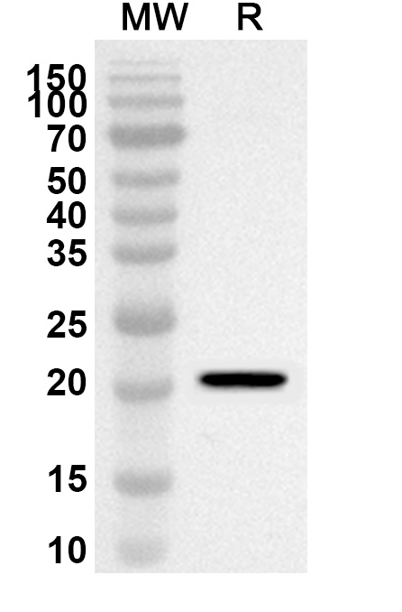 Anti-Human TRIM69 Polyclonal Antibody binds to Recombinant Human TRIM69 Protein, N-His in WB Assay