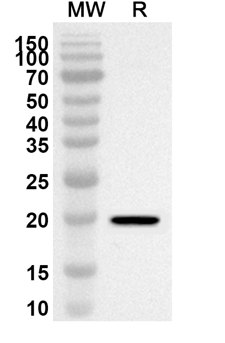 Anti-Human TROAP Polyclonal Antibody binds to Recombinant Human TROAP Protein, N-His-SUMO in WB Assay