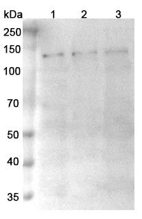 Anti-Human TRPM4/LTRPC4 Monoclonal Antibody, SAA0760 in WB Assay