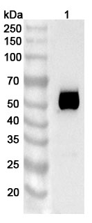 Anti-Human TSHR Antibody (SAA0401) binds to Human TSHR Recombinant Protein, N-His in WB Assay