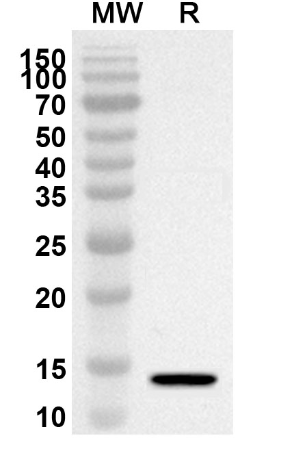 Anti-Human TSPAN1 Polyclonal Antibody binds to Recombinant Human TSPAN1 Protein, N-His in WB Assay